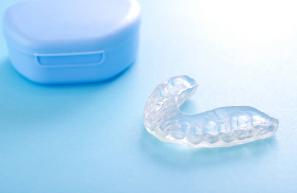 マウスピース矯正の仕組み